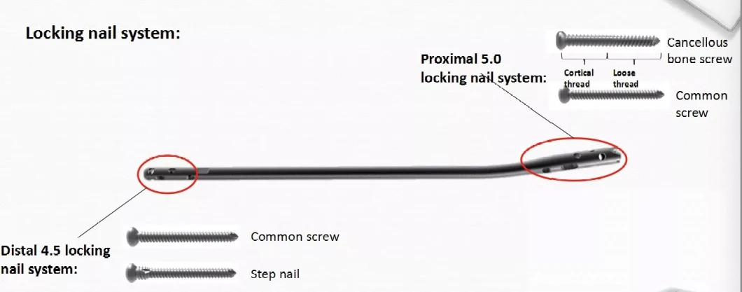 Orthopedic Implant Trauma Pure Titanium Surgical Bone Adult Medical Supply Product ISO CE Without Ethylene Oxide Sterilization Interlocking Intramedullary Nail